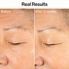 Ageless Firm + Even Serum